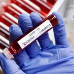 Understanding More About Covid-19 Pandemic